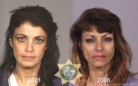 Внешность наркомана до и после [21 фото]