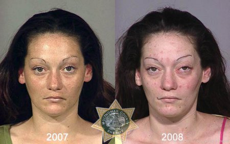 Внешность наркомана до и после [21 фото]